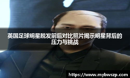 英国足球明星脱发前后对比照片揭示明星背后的压力与挑战